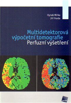 Multidetektorová výpočetní tomografie - Hynek Mírka, Jiří Ferda - obrázek 1