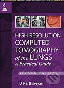 High Resolution Computed Tomography of the Lungs - D. Karthikeyan - obrázek 1