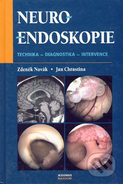 Neuroendoskopie - Zdeněk Novák, Jan Chrastina - obrázek 1