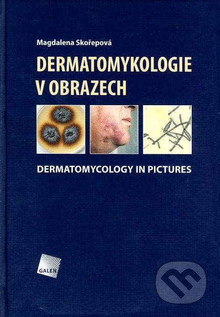 Dermatomykologie v obrazech - Magdalena Skořepová - obrázek 1