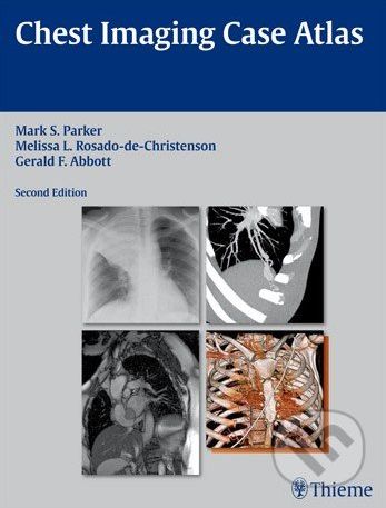 Chest Imaging Case Atlas - Mark S. Parker - obrázek 1