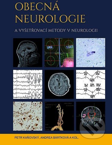 Obecná neurologie a vyšetřovací metody v neurologii - Petr Kaňovský - obrázek 1