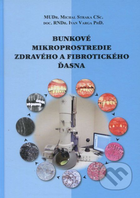 Bunkové mikroprostredie zdravého a fibrotického ďasna - Michal Straka - obrázek 1