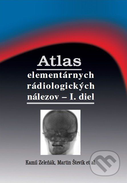 Atlas elementárnych rádiologických nálezov - I. diel - Kamil Zeleňák, Martin Števík a kolektív - obrázek 1
