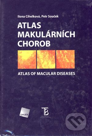 Atlas makulárních chorob - Ilona Cihelková, Petr Souček - obrázek 1