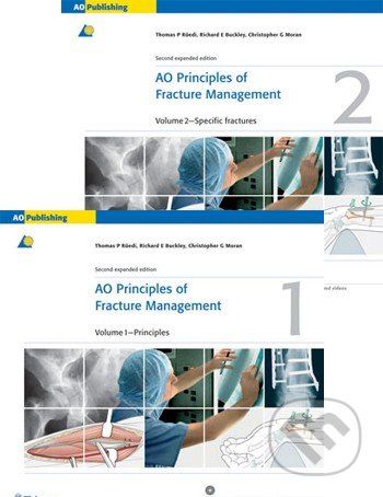AO Principles of Fracture Management - - obrázek 1