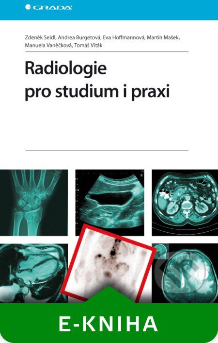 Radiologie pro studium i praxi - Zdeněk Seidl a kolektív - obrázek 1