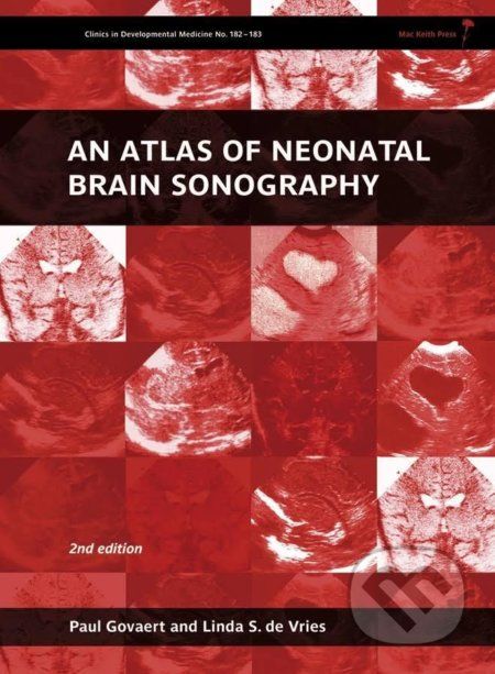 An Atlas of Neonatal Brain Sonography - Paul Govaert, Linda S. de Vries - obrázek 1