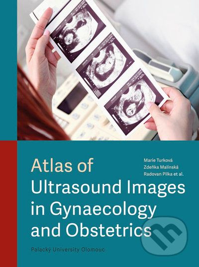 Atlas of Ultrasound Images in Gynaecology and Obstetrics - Marie Turková, Zdeňka Malínská, Radovan Pilka, kolektiv autorů - obrázek 1