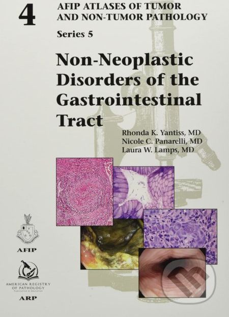 Non-Neoplastic Disorders of the Gastrointestinal Tract - Rhonda K. Yantiss, Nicole C. Panarelli, Laura W. Lamps - obrázek 1
