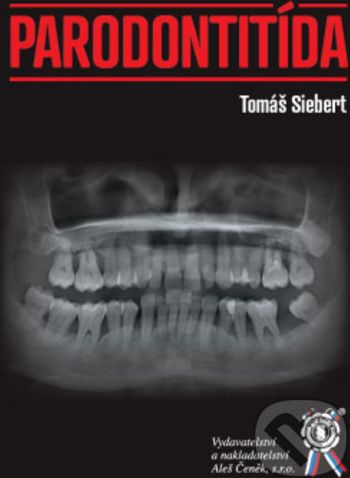 Parodontitída - Tomáš Siebert - obrázek 1
