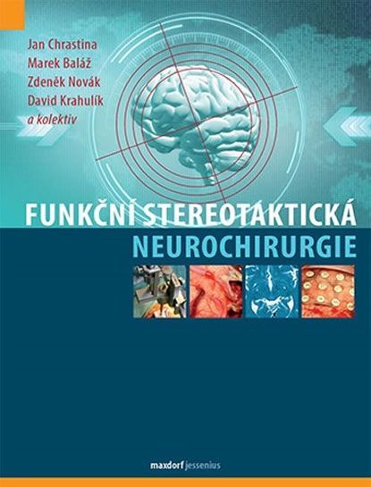 Funkční stereotaktická neurochirurgie - Jan Chrastina a kolektív autorov - obrázek 1