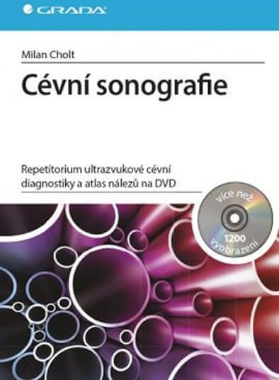 Cholt Milan: Cévní sonografie - repetitorium ultrazvukové cévní diagnostiky a atlas nálezů na DVD - obrázek 1