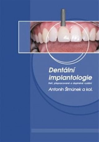 Dentální implantologie, 3. přepracované a doplněné vydání - obrázek 1